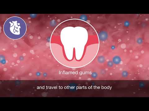 Oral and general health animation
