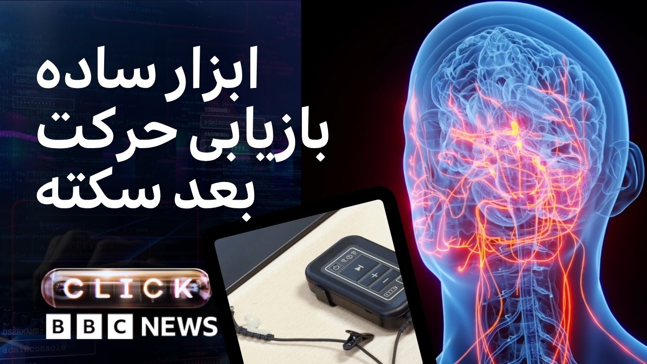کلیک؛ فناوری برای برگرداندن حرکت بعد از سکته