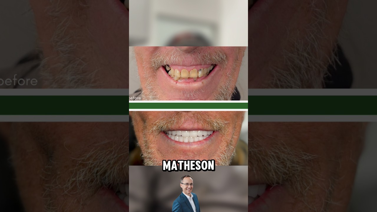 Troy D. (All on X tops and bottoms)