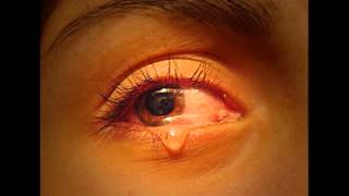 Download lagu Viky Sianipar & Korem Sihombing - Mardalan Ahu Marsada mp3