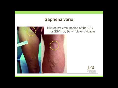 The Importance of the Clinical Examination of the Patient With Venous Disease: Webinar