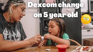 Dexcom change on our type one diabetic 5 year old!