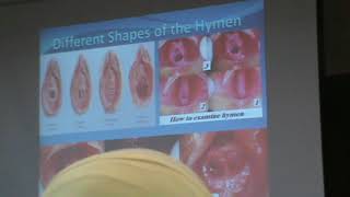 21.Dr. Nadine - Anatomy of female pelvis