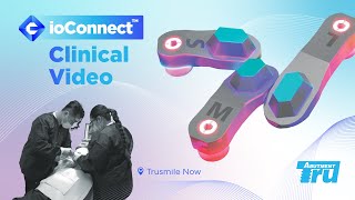 ioConnect Clinical Video - Dr. Han Choi