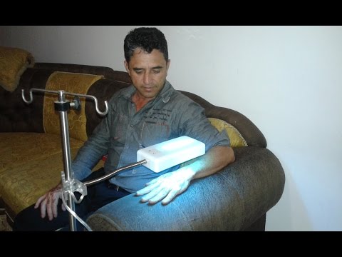 I pigmentary notano su una natica Macchie di pigmentary scure dopo abbronzatura