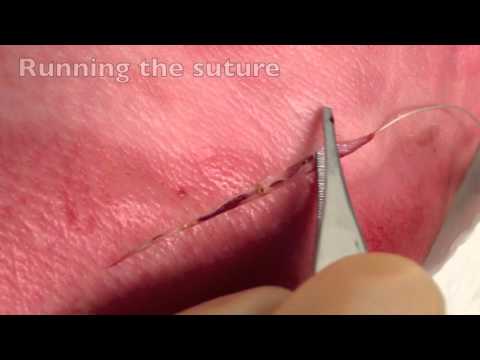 Running Subcuticular Suturing