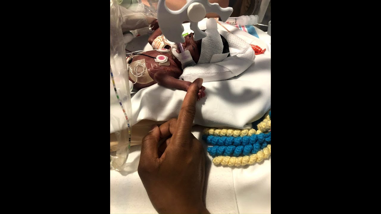 Decision-making in the NICU: When the mom and dad are thinking at different scales of time