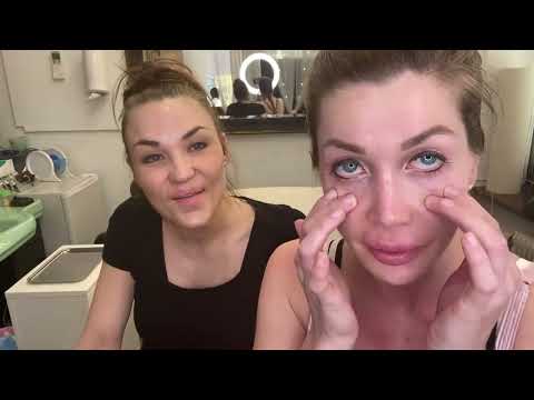 Pixee Fox remove Brightocular iris implants after 5 years