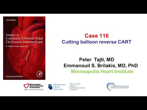 Case 116: Manual of CTO Interventions: Cutting-balloon assisted reverse CART