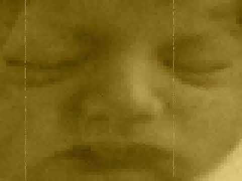 Axel dario historia 0-12 años