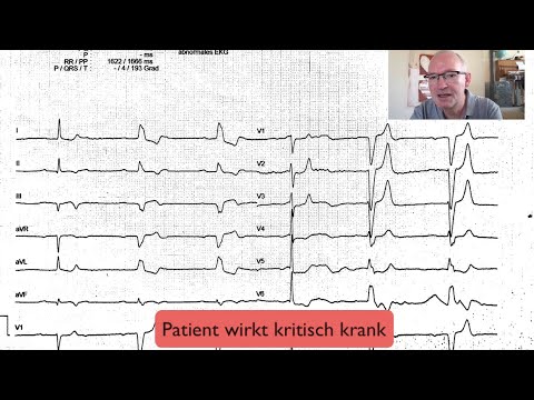 ECG Quickie: Bradycardia, Block image, Barcelona?!