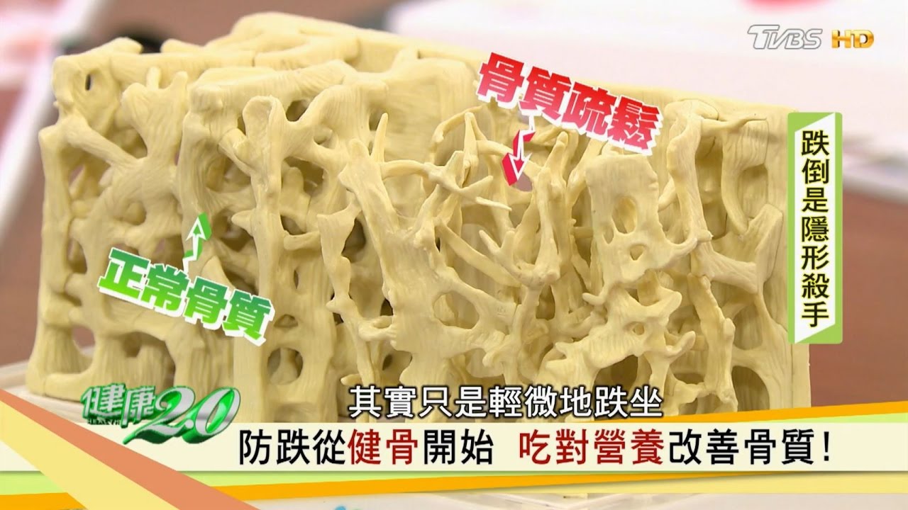 【健康2.0】骨質疏鬆怎麼救 從生活飲食培養