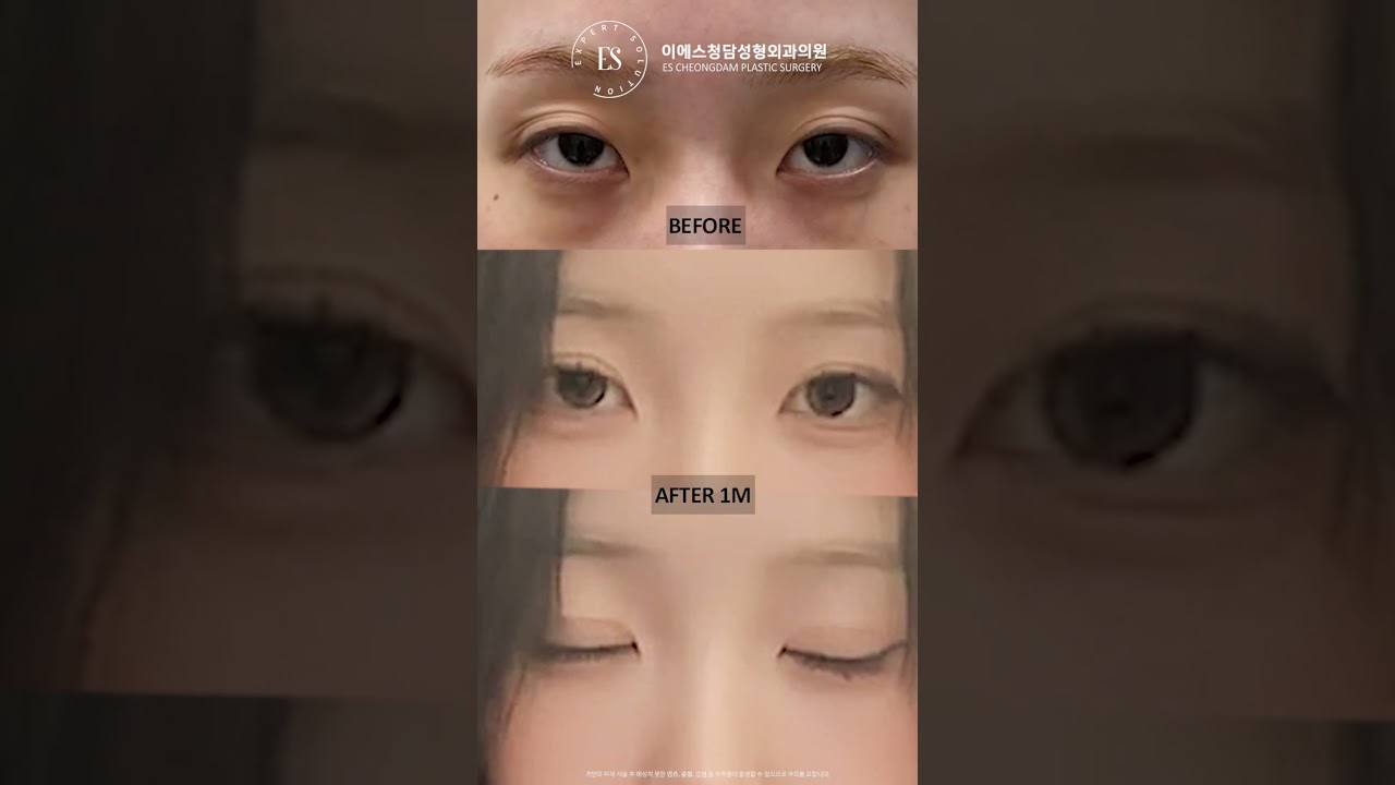 이에스 유튜브