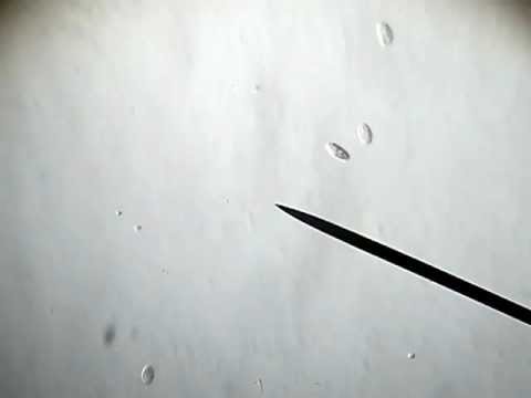 Lyambliya in gas di intestini Togliere un lyambliya