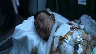 preview picture of video 'Children of Gaza, shot in the head.'
