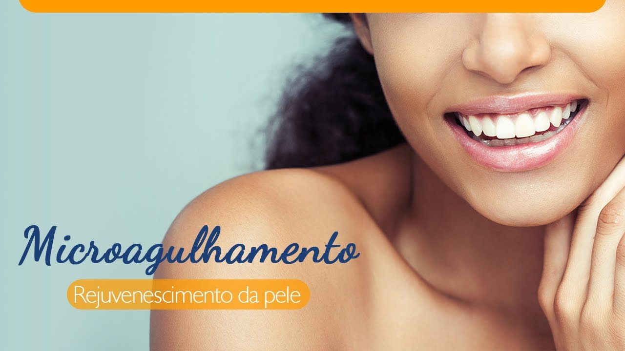 Indução Percutânea de Colágeno com Agulhas - IPCA® (Microagulhamento)