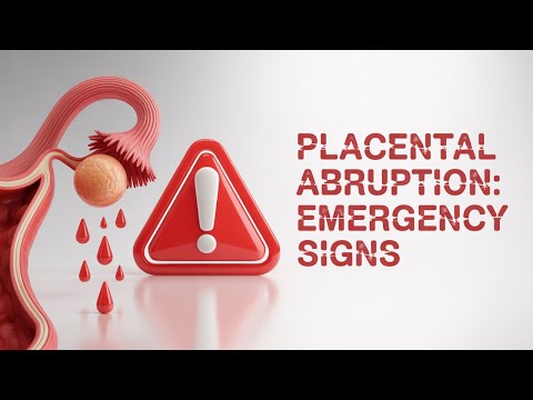 Placental Abruption: Emergency Signs | USMLE High Yield