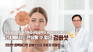 脂漏性角化症は年配の方だけの問題ではありません