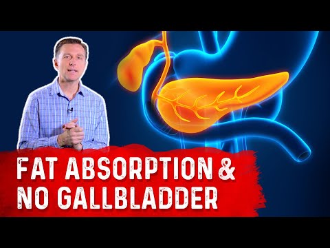 12 Complications of Having Your Gallbladder Removed