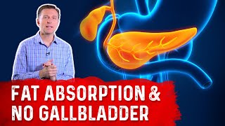 What Happens to Fat Absorption With NO Gallbladder?