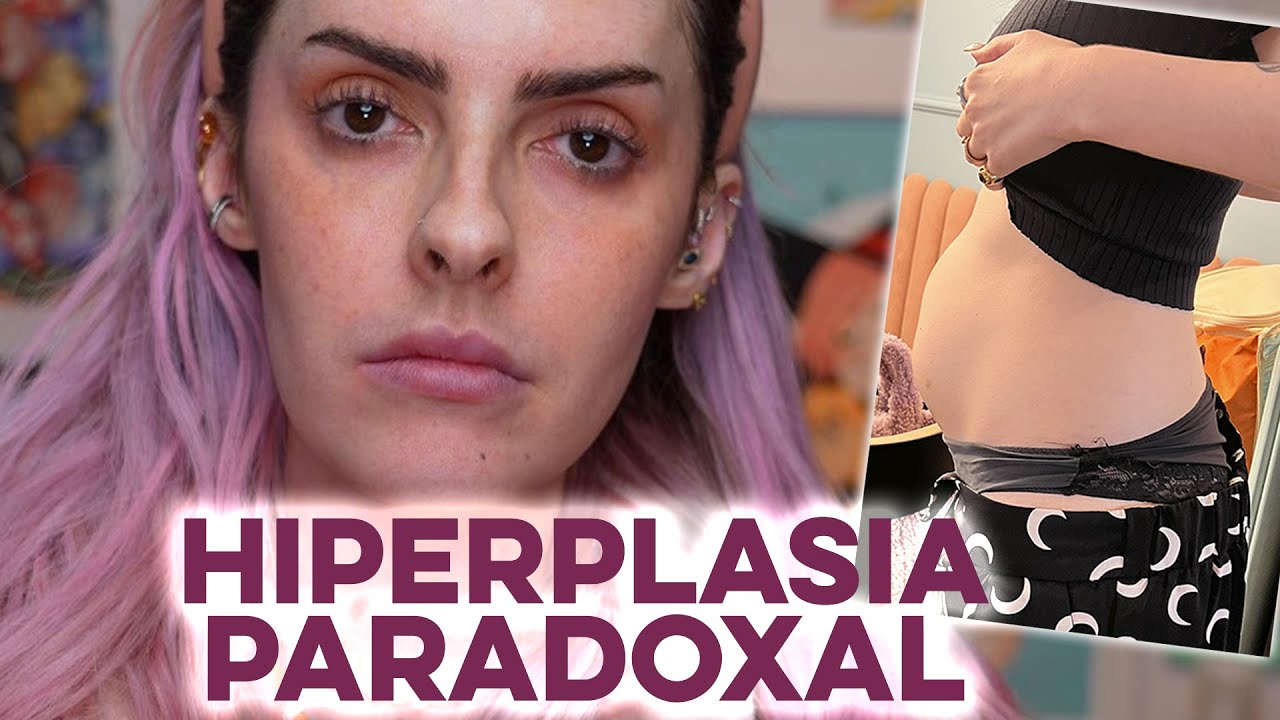 O QUE ACONTECEU COMIGO? - Karen Bachini