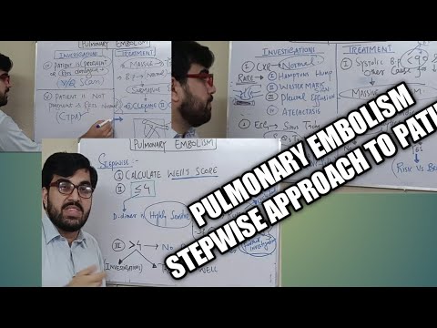 Pulmonary embolism(part 1) stepwise approach| on google | hamptons hump | high blood pressure | cure