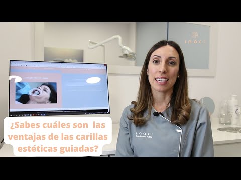 Ventajas carillas guiadas