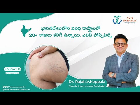 India’s leading vascular center with 20+ branches | Avis Hospitals