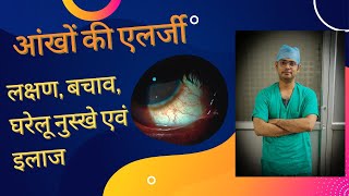 Allergic conjunctivitis eye allergy, redness, itching, watering, causes, home remedies and treatment