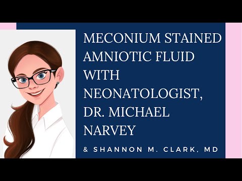 Meconium stained amniotic fluid and meconium aspiration syndrome