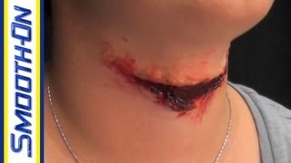 Ultimate Wound Kit Video: