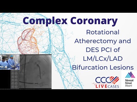 Rotational Atherectomy and DES PCI of LM/LCx/LAD Bifurcation Lesions - CCC Live Nov 2016