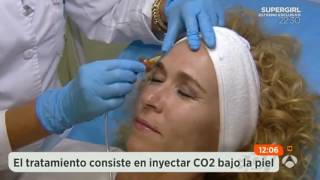 Doctora Téllez en Espejo Público A3 - Tratamientos: Carboxiterapia, en Madrid - Ana Mª Téllez Delgado