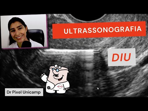 Ultrassonografia na avaliação do DIU