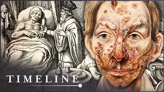 The True Terrors Of Tudor Medicine | Hidden Killers | Timeline