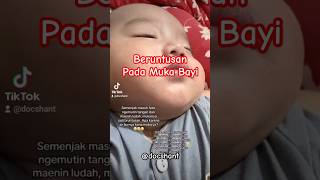 Download lagu Beruntusan pada muka bayi, apa penyebabnya? #baby #bayi #infokesehatan #kesehatan #kesehatanbayi mp3