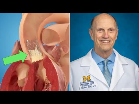 5 Must-Know Facts About TAVR for Aortic Valve Patients