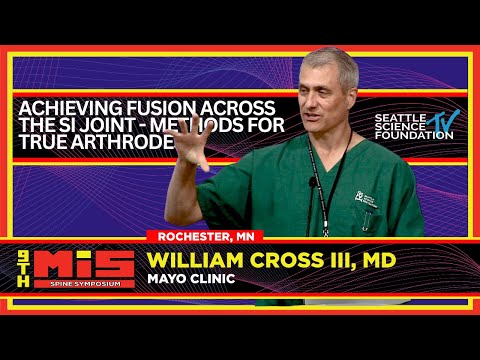 Achieving Fusion Across the SI Joint   Methods for True Arthrodesis -  William Cross, M.D.