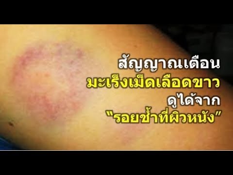 รักษาความอ่อนแอในร้านขายยาของกรุงมอสโก วิธีการเพิ่ม priporatami สมาชิก