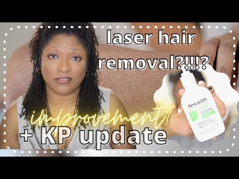 YouTube video about: Does laser hair removal get rid of strawberry legs?