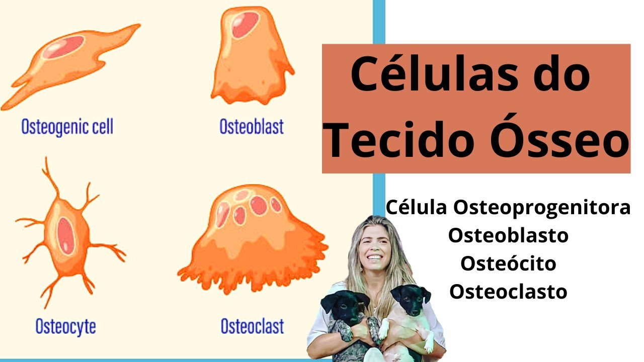 Células do Tecido Ósseo: célula osteoprogenitora, osteoblasto, osteócito e osteoclasto