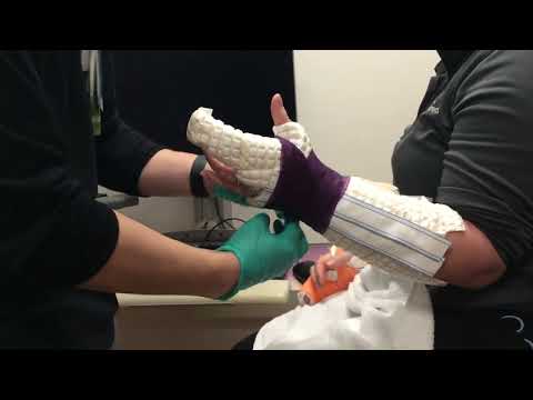 Radial gutter waterproof cast