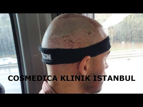 Operation Istanbul + 14 Tage Update | COSMEDICA Hair...