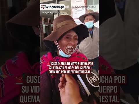 Cusco: adulto mayor queda con el 90 % del cuerpo quemado tras incendio forestal en Acomayo