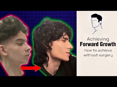 Here’s How to achieve forward growth and be attractive