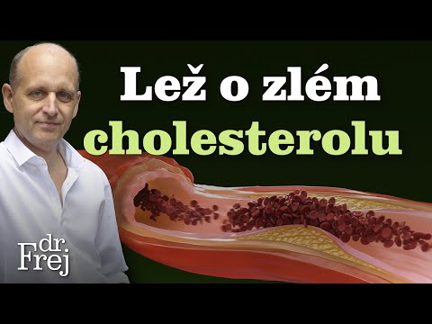 Lež o zlém cholesterolu – MUDr. David Frej