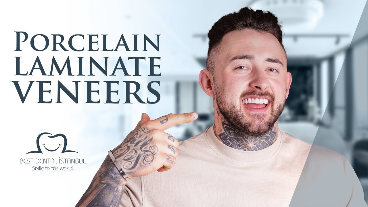 Achieve the smile of your dreams with Best Dental Istanbul: Tom’s Story