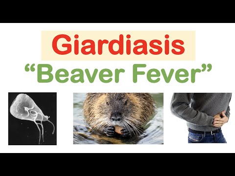 Giardiasis (Beaver Fever) Infection Sources, Pathophysiology, Signs & Symptoms, Diagnosis, Treatment