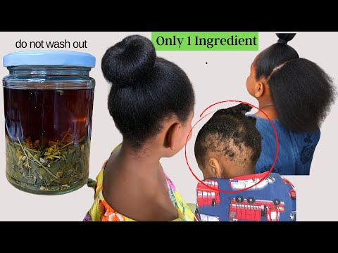 Extremely Effective Natural Remedy To Fight Hair Loss And Speed Up Hair Growth