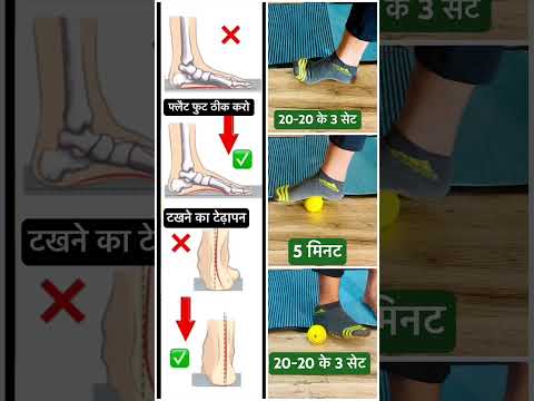 गंभीर समस्या को आने से पहले ही रोक दो |🚫#flatfoot #anklepain #kneepain